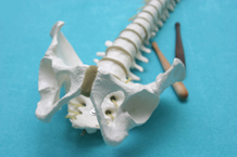 Pr&auml;ventive R&uuml;ckenschule